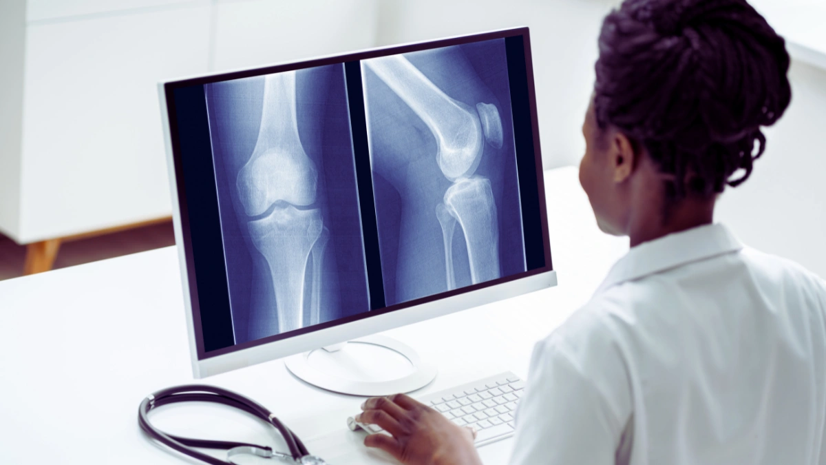 Bone Fracture Detection